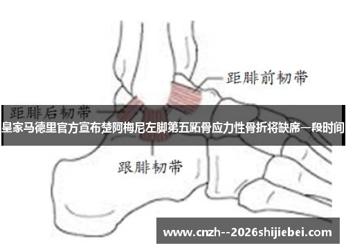 皇家马德里官方宣布楚阿梅尼左脚第五跖骨应力性骨折将缺席一段时间